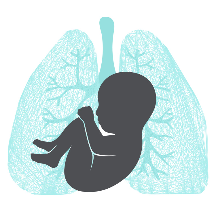 Stanford Bronchopulmonary Dysplasia (BPD) Research Symposium